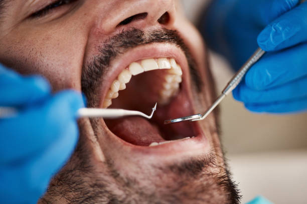 Best Emergency Dentist for Lost Fillings or Crowns in Sallisaw, OK